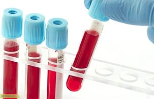 چگونه میتوان برگه آزمایش خون را تفسیر کرد؟