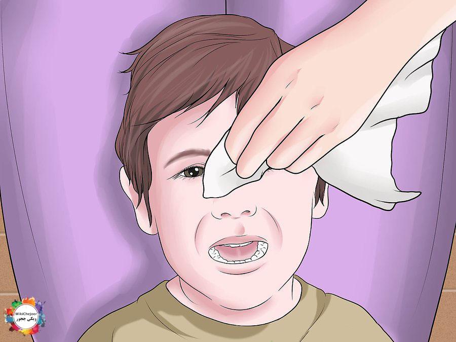 چگونه قطره چشم به کودک بدهیم؟